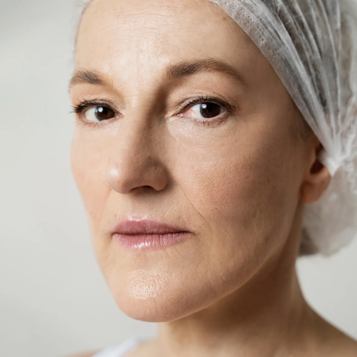 before and after Med Spa in Scottsdale & Phoenix AZ | Aesthetic Beauty Treatments