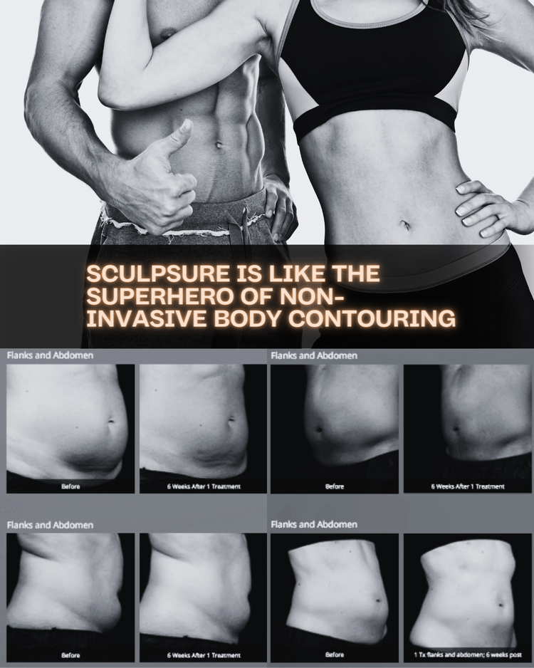 Before and after sculpting