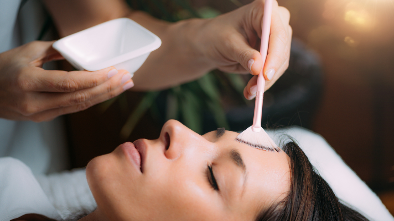 chemical-peel