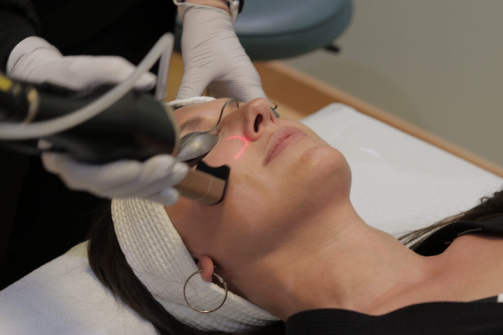 Expert IPL Photofacial Treatments in Scottsdale & Near Phoenix